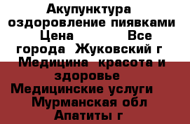 Акупунктура, оздоровление пиявками › Цена ­ 3 000 - Все города, Жуковский г. Медицина, красота и здоровье » Медицинские услуги   . Мурманская обл.,Апатиты г.